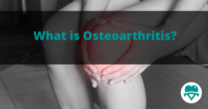 Read more about the article What is Osteoarthritis?